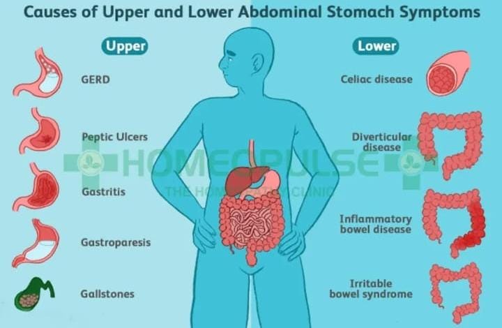 Sering Mengalami Nyeri Perut Bagian Atas? Kenali Penyebab dan Pengobatannya