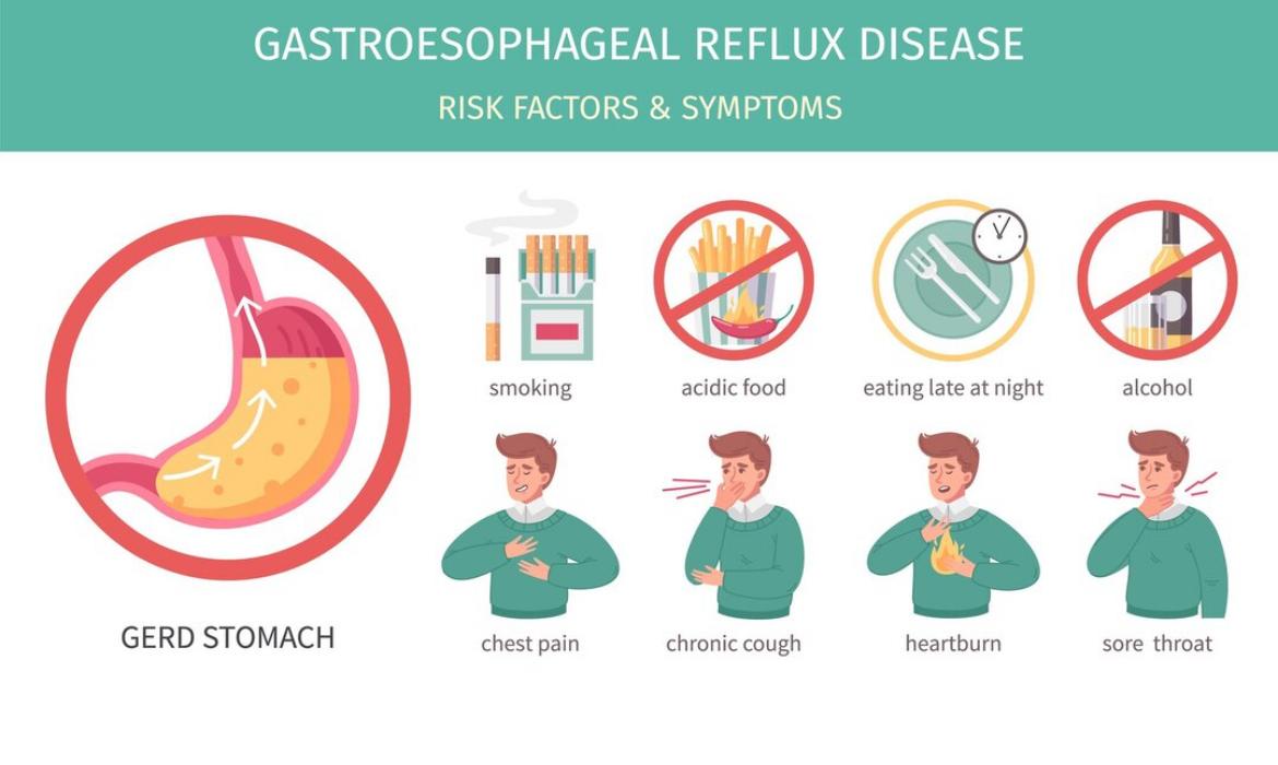 Mengenal GERD: Penyebab, Faktor Risiko, dan Penanganannya