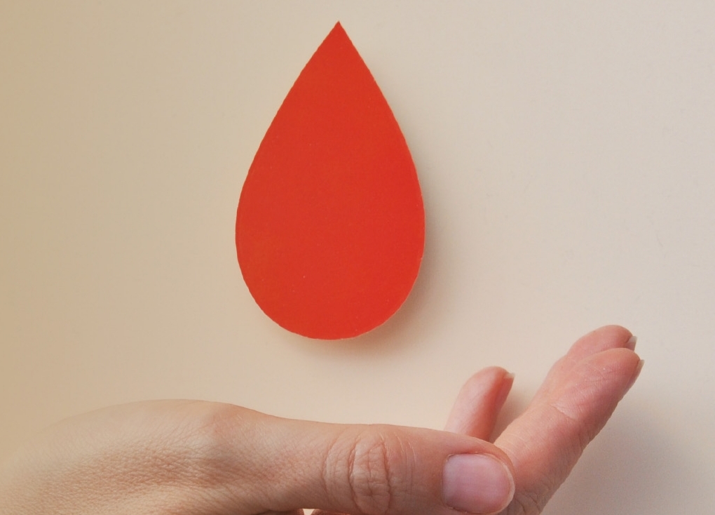 Wah! Pria Lebih Rentan Terkena Hemofilia